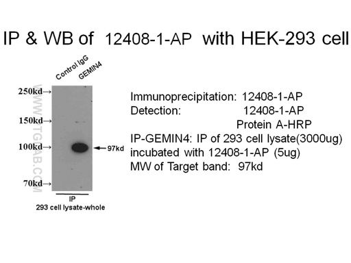 [12408-1-AP-150UL] GEMIN4 Polyclonal antibody
