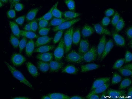 [12412-1-AP-20UL] GSTM1 Polyclonal antibody