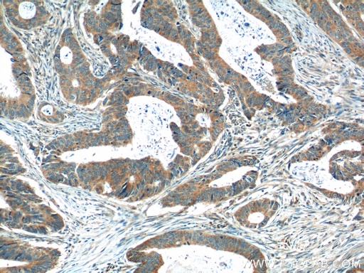 [12417-1-AP-20UL] OSBPL3 Polyclonal antibody