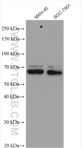 [12418-1-AP-20UL] TEAD4 Polyclonal antibody