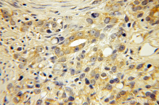 [12419-1-AP-150UL] EDF1 Polyclonal antibody