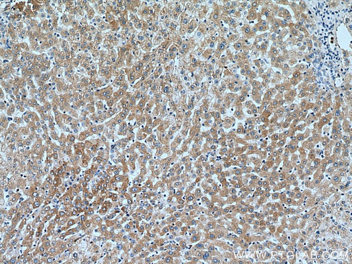 [12423-1-AP-20UL] SLC20A1 Polyclonal antibody