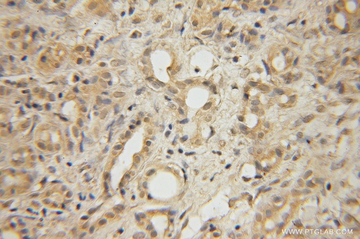 [12426-1-AP-150UL] GLYCTK Polyclonal antibody