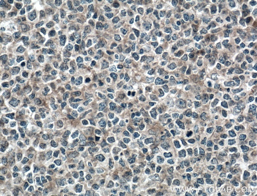 [12432-1-AP-20UL] MYO9B Polyclonal antibody