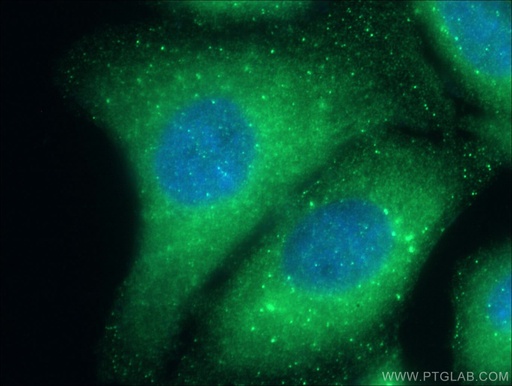 [12434-1-AP-20UL] STAM Polyclonal antibody