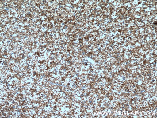 [12435-1-AP-150UL] SH3GL2 Polyclonal antibody