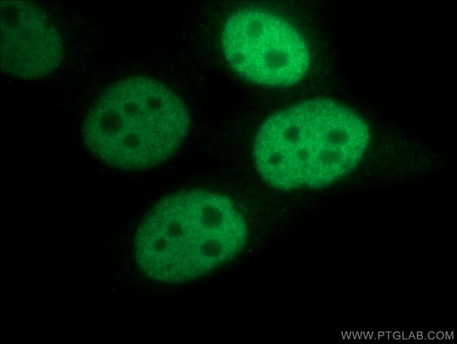 [12439-1-AP-20UL] CREST Polyclonal antibody