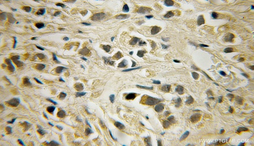 [12441-1-AP-20UL] SHPK Polyclonal antibody