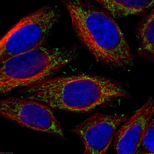 [12444-1-AP-150UL] NDUFS1 Polyclonal antibody