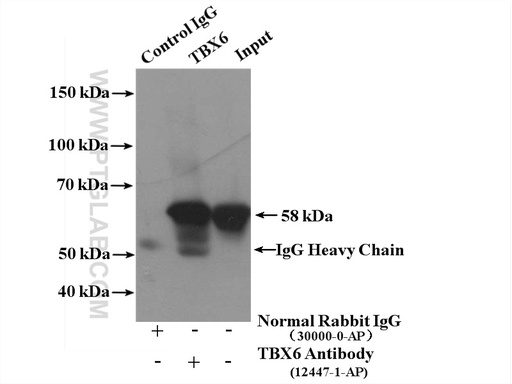 [12447-1-AP-150UL] TBX6 Polyclonal antibody