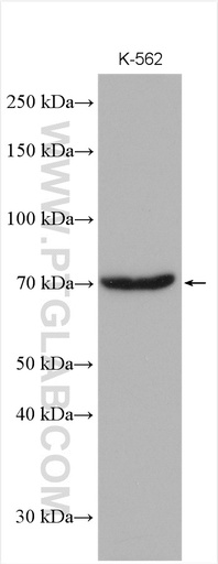[12448-1-AP-150UL] RPA1 Polyclonal antibody