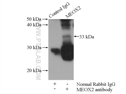 [12449-1-AP-150UL] MEOX2 Polyclonal antibody