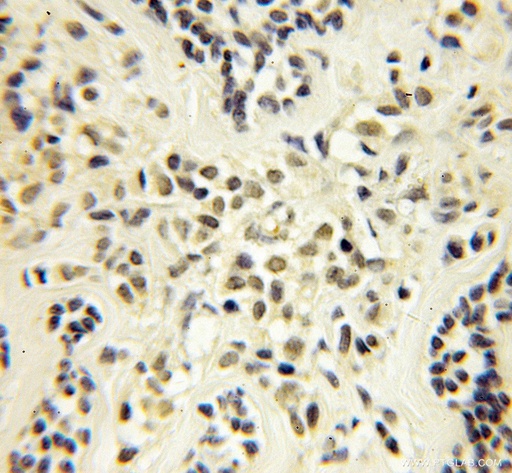 [12450-1-AP-150UL] TCEB1 Polyclonal antibody