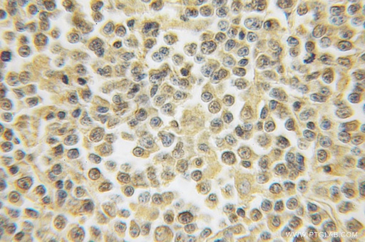 [12453-1-AP-20UL] HS2ST1 Polyclonal antibody