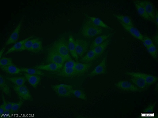 [12455-1-AP-150UL] EPS8 Polyclonal antibody
