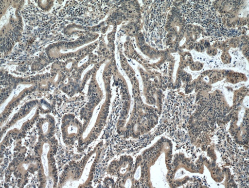[12456-1-AP-20UL] PDCD5 Polyclonal antibody