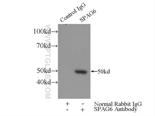 [12462-1-AP-150UL] SPAG6 Polyclonal antibody