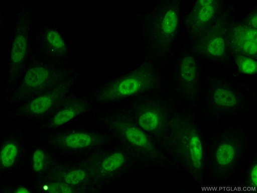 [12463-1-AP-20UL] KPNA4 Polyclonal antibody