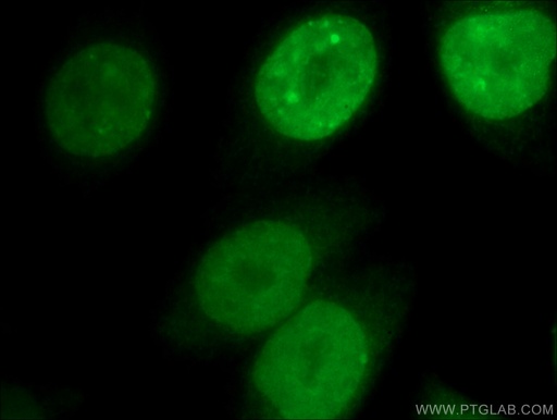 [12465-1-AP-150UL] CDCA8 Polyclonal antibody