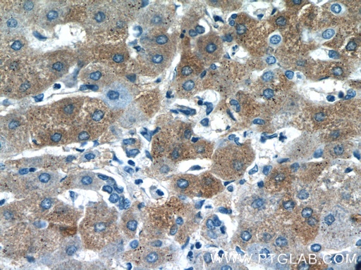 [12466-1-AP-20UL] PANK1/2/3 Polyclonal antibody