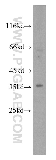 [12467-1-AP-150UL] RHBDL2 Polyclonal antibody