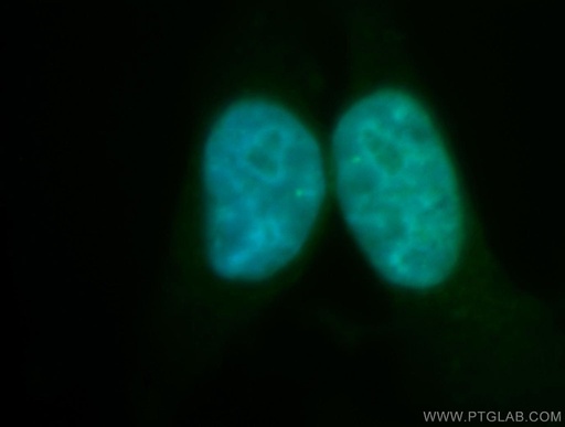 [12468-2-AP-20UL] RECQL5 Polyclonal antibody