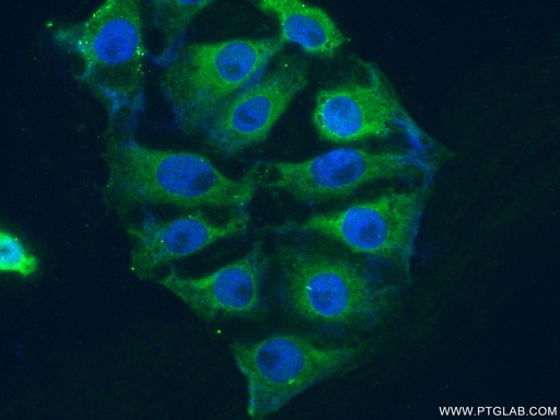 [12469-1-AP-20UL] PIP4K2A Polyclonal antibody