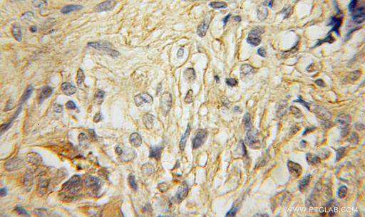 [12471-1-AP-20UL] RAB40B Polyclonal antibody