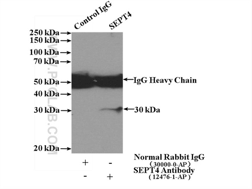 [12476-1-AP-150UL] SEPT4 Polyclonal antibody