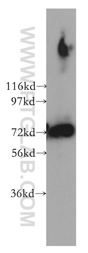 [12478-1-AP-20UL] PREPL Polyclonal antibody