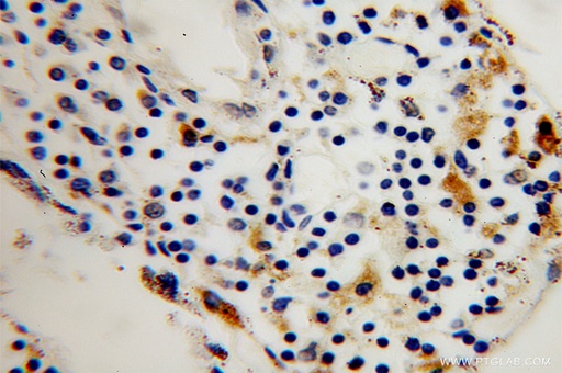 [12479-1-AP-150UL] TPP1 Polyclonal antibody