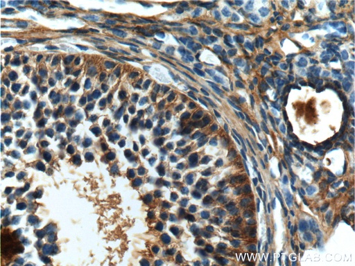 [12481-1-AP-150UL] COQ6 Polyclonal antibody