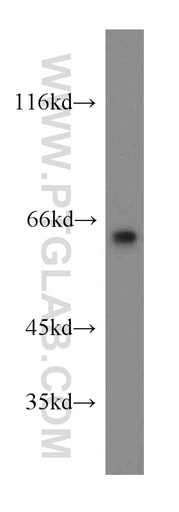 [12483-1-AP-150UL] LGI1 Polyclonal antibody