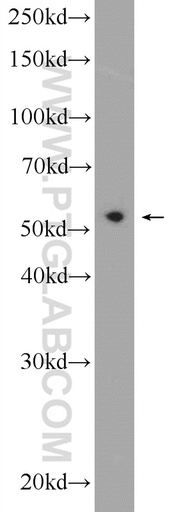 [12485-1-AP-150UL] PDCD7 Polyclonal antibody