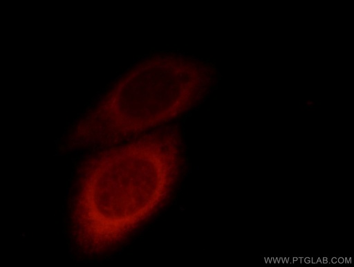 [12488-1-AP-150UL] TBL2 Polyclonal antibody