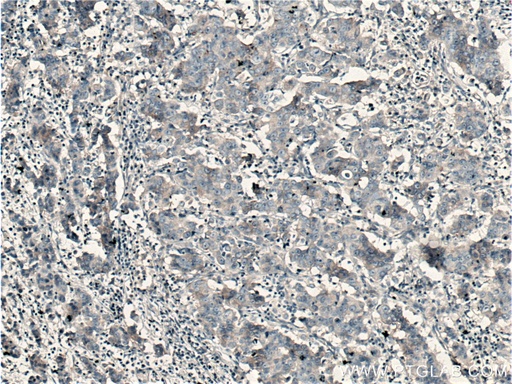 [12493-1-AP-20UL] SGEF Polyclonal antibody