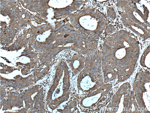 [12494-1-AP-20UL] CD46 Polyclonal antibody