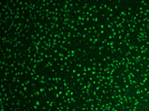 [12498-1-AP-20UL] FOX2/RBM9 Polyclonal antibody