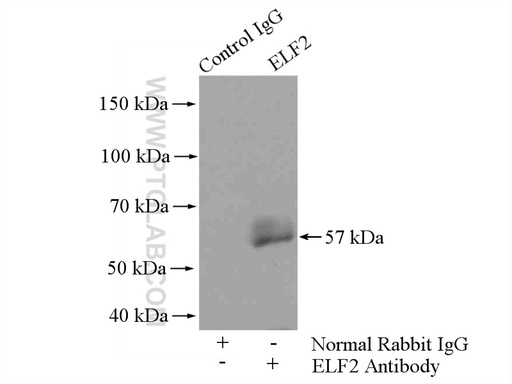 [12499-1-AP-150UL] ELF2 Polyclonal antibody