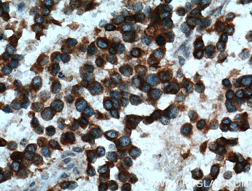[12503-1-AP-20UL] Kir4.1 Polyclonal antibody