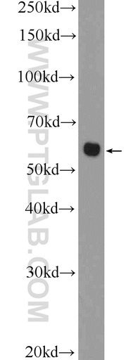 [12504-1-AP-150UL] CHST1 Polyclonal antibody
