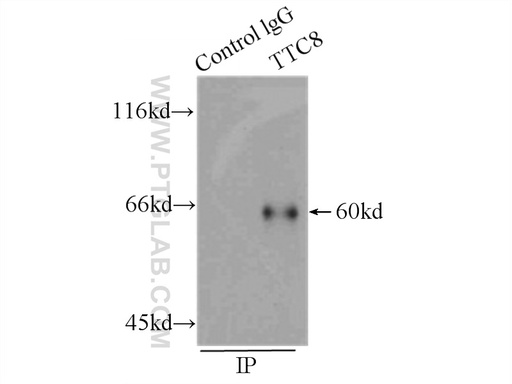 [12505-1-AP-150UL] BBS8 Polyclonal antibody