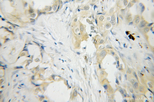 [12506-1-AP-150UL] PLEK Polyclonal antibody