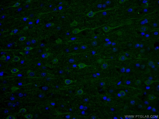 [12510-2-AP-20UL] AK5 Polyclonal antibody