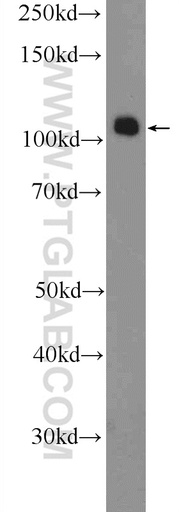[12513-1-AP-20UL] SMARCAL1 Polyclonal antibody