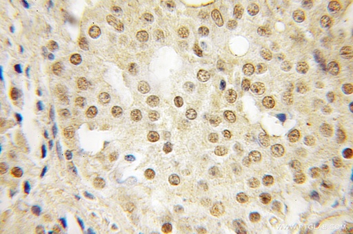[12514-1-AP-150UL] SFRS14 Polyclonal antibody
