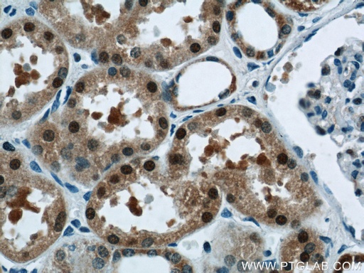 [12520-1-AP-20UL] TRUB1 Polyclonal antibody