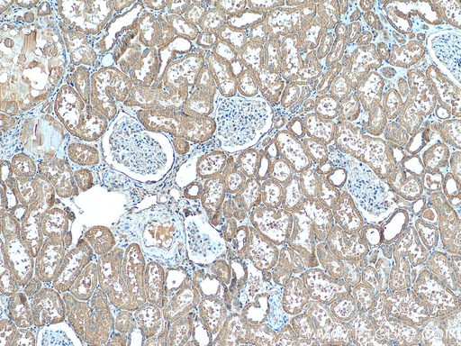 [12521-1-AP-150UL] TMOD3 Polyclonal antibody