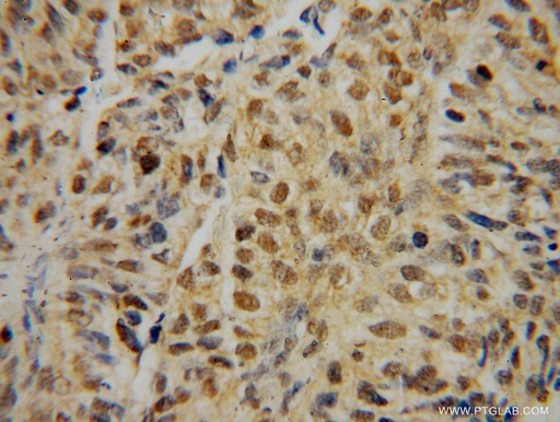 [12525-1-AP-150UL] IRF2 Polyclonal antibody
