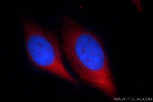 [12527-1-AP-20UL] CHMP2B Polyclonal antibody